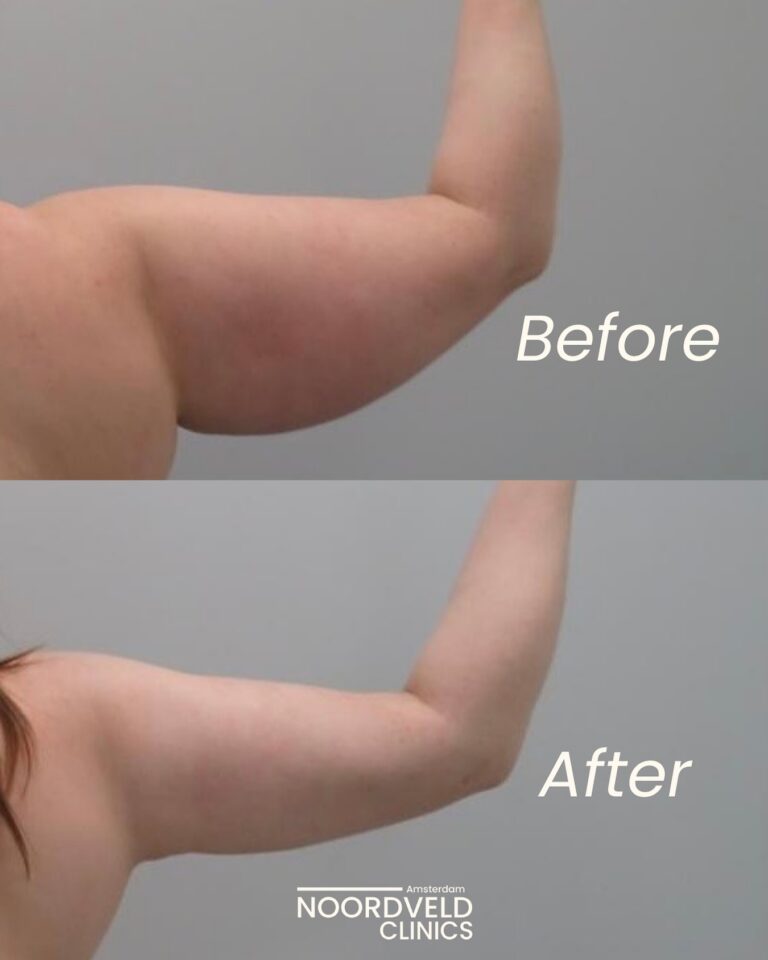 Instagram post from noordveldclinics. This post is in position 1.