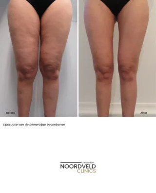 Instagram post from noordveldclinics. This post is in position 1.