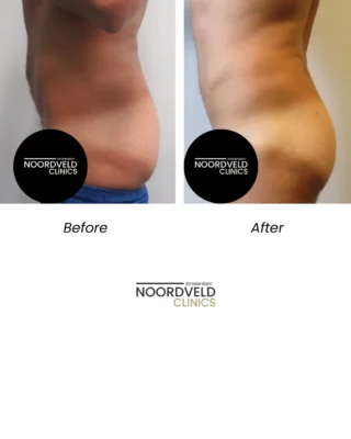 Instagram post from noordveldclinics. This post is in position 4.